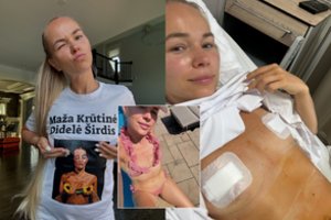 Krūtinę susimažinusiai I. Voveris vyras negailėjo aštrios kritikos: sulaukė palyginimo su buvusiomis