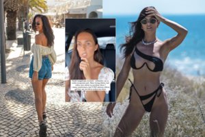 Botokso injekcija Ievai Swan sukėlė veido paralyžių: įspėja kitas moteris