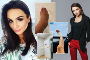 Garsioji mokytoja Veronika patyrė traumą: Rugsėjo 1-oji bus kiek kitokia