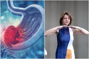 Gydytoja susirgo vėžiu, bet nepuolė į paniką: „Pats geriausias patyrimas gyvenime“