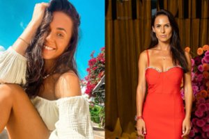 Po žinios apie veidą suparalyžiavusią botokso injekciją Ieva Swan nustebo: moterų, kaip ji, daugiau nei manė