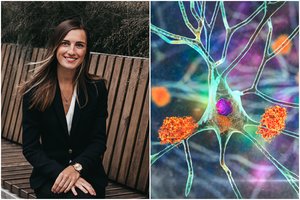 Neuromokslininkė įvardijo, kas išvalo smegenis ir saugo nuo Alzheimerio ligos