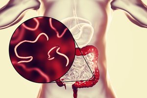 Kirmėlės tarp mūsų: gresia ne tik vaikams