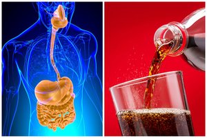 Kas atsitinka virškinimo sistemai, jei kasdien geriate „coca-colą“