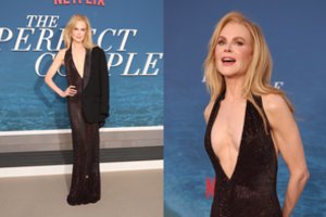 Dėl savo pasikeitusios išvaizdos Nicole Kidman atsidūrė dėmesio centre: plastikos chirurgas paaiškino, kas nutiko