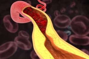 Maža tauta pribloškė mokslininkus: jų kraujagyslėse nesikaupia riebalai, o kraujospūdis išlieka idealus net senatvėje