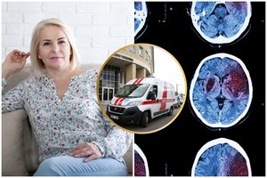 Moteris apie insultą įspėja neįprasti simptomai: svarbu atpažinti šiuos ženklus