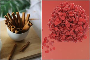 Įsidėmėkite: 5 produktai, kurie natūraliai skystina kraują ir kliudo atsirasti krešuliams