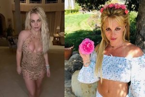 Ugnis apdarkė Britney Spears išvaizdą: „Skaudėjo vos prisilietus“
