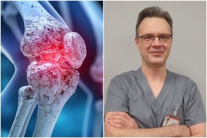 Neramu dėl dylančių sąnarių? Gydytojas įvardijo geriausią „vaistą“