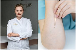 Rudenį apžiūrėkite odą: tai – pavojaus sveikatai ženklai