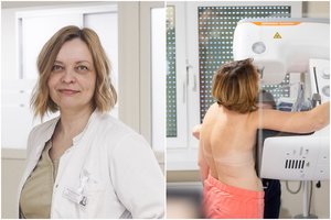 Vėžys gali vystytis be simptomų: išvardijo, kam priklauso nemokami tyrimai