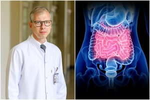 Profesorius patarė, kokiu būdu žarnyne padidinti gerųjų bakterijų kiekį: „Manęs labai nemėgsta probiotikų kompanijos“