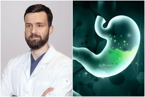 Skrandžio siunčiami simptomai, kurių gydytojas ragina neignoruoti: nebijokite, „ryti žarnos“ nereikės