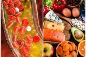 Ką valgyti, kad sumažėtų cholesterolis: 32 maisto produktai, gydantys organizmą