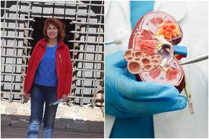 Prieš vilnietės ligą medicina buvo bejėgė: išgelbėjo vieną naktį įvykęs stebuklas