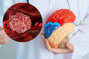 Išmokite kaip maldą: 8 esminės taisyklės padės išvengti insulto