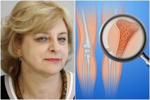 Profesorė įspėjo dėl vaistų, kurie ypač skatina kaulų retėjimą: labai nepasisekė moterims