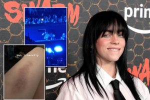 Billie Eilish scenoje patyrė fiasko: susižalojo ne juokais