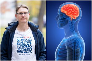 Gydytojas įspėjo: kraujotakos sutrikimą išduoda 5 požymiai – kas juos pražiopso, neišgyvena nė metų