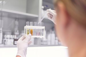 Lietuviai kuria analogų neturinčias priemones nuo aknės