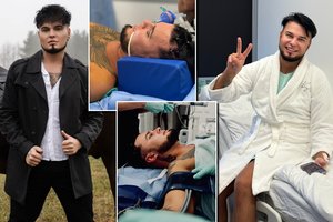 Ant operacinės stalo gulęsis Vytenis Partikas: „Buvo rizika, kad veidas bus visam gyvenimui suparalyžiuotas“