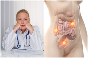 Jauna gydytoja suprato, kad serga klastingu vėžiu: įtarimų sukėlė 2 simptomai