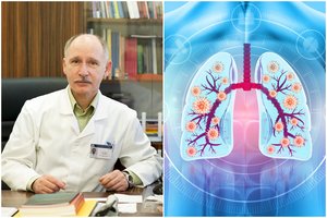 Klastinga plaučių liga – grėsmė gyvybei: profesorius lieja apmaudą, kad pirmą simptomą daugelis pražiopso
