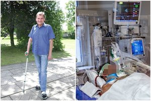 Akistata su virusu panevėžiečiui vos nesibaigė mirtimi: viskas prasidėjo nuo menko karščiavimo
