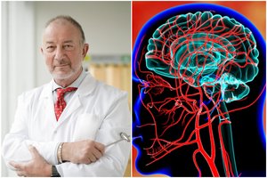 Neurologas J. Fišas pasakė, kaip pagerinti smegenų kraujotaką: ypač svarbūs šie vitaminai