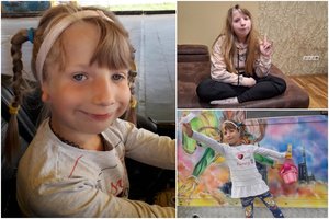 Gimus dukrai klaipėdietę ištiko šokas ir pasipylė ašaros: be ausyčių ir sumaitotu veidu