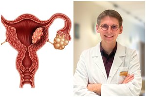 Gimdos polipai: nors gerybiniai, ne tokie jau nekalti