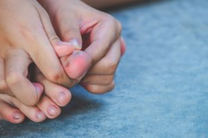 Įaugusių nagų problema dažnėja tarp paauglių – paaiškino, kurie gydymo būdai nėra veiksmingi