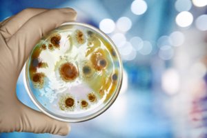 „Problema iš tiesų yra didelė“: skelbia, kad tai kasmet pražudo dešimtis tūkstančių europiečių