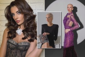 Onkologine liga susirgusi Miglė: „Vaikinas man tėškė – nevaidink čia gražios, taigi tu su peruku“