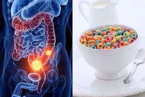 Nenorite susirgti storosios žarnos vėžiu? Išbraukite šį maistą iš savo valgiaraščio