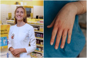 Vaistininkė: sausa oda ir pablogėjusi atmintis gali byloti apie svarbios medžiagos trūkumą 