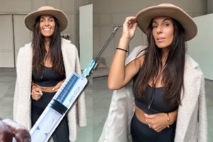 Injekcijos sukeltas veido paralyžius buvo atėmęs Ievos Swan galimybę šypsotis: „Vienas neatidžiausių sprendimų“