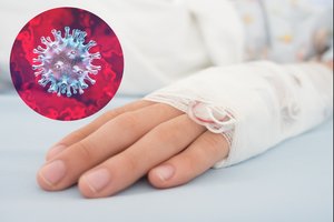 Netikėta: koronavirusas gali padėti kovoje su vėžiu