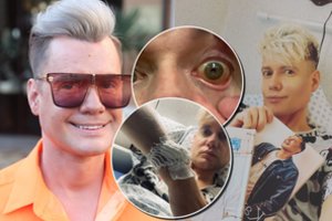 Pageltus akių obuoliams ir veido odai K. Murauskas atsidūrė ligoninėje: „Esu emociškai sužlugdytas“