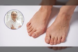 Iššokę pėdų kauliukai: ką reikia žinoti ir kaip sau padėti?