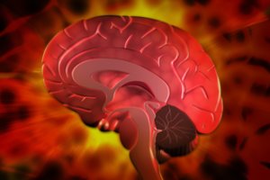 Ekspertai įspėja: per didelis populiaraus vitamino vartojimas didina kraujavimo iš smegenų riziką