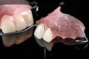 Bedantystė – ne nuosprendis: gyvenimą keičia odontologijos galimybės