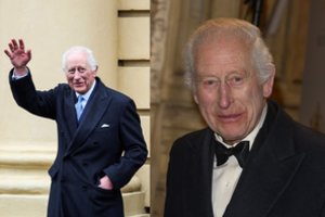 Paaiškėjo, ko kovoje su vėžiu ėmėsi karalius Karolis III: būdas neįprastas