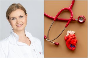 Kardiologė įspėjo: lipant laiptais atsiradęs simptomas gali signalizuoti apie širdies ligą