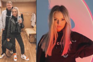 Ugnė Siparė prakalbo apie ilgai svarstytą plastinę operaciją: „Galvojau, pasidarysiu tyliai“