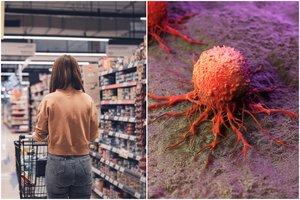 Įtaria atradę ingredientą, kuris skatina vėžinių navikų augimą: štai ko vengti parduotuvėje