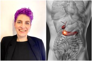 Kad serga vėžiu, 41-erių moteris išgirdo prieš pat Kalėdas: apie klastingą ligą įspėjo keli simptomai