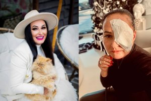 Verslininkei Ingai Budrienei atlikta rimta operacija: akis – užbintuota, laukia mėlynės