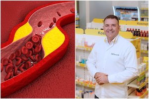 Cholesterolio ir vėžio priešas – mineralas, kurio nauda stulbina